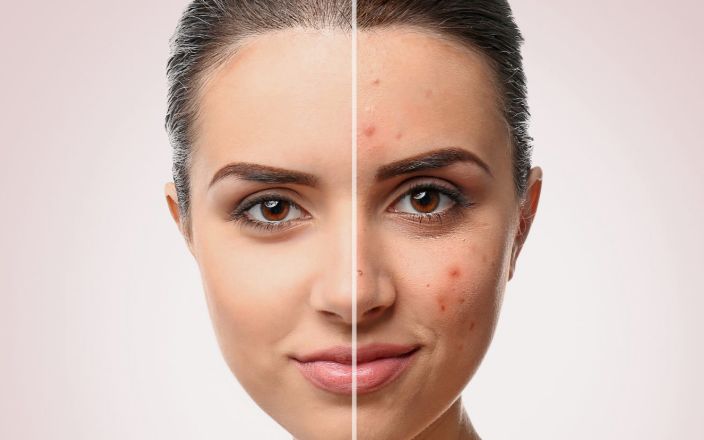 Before &After